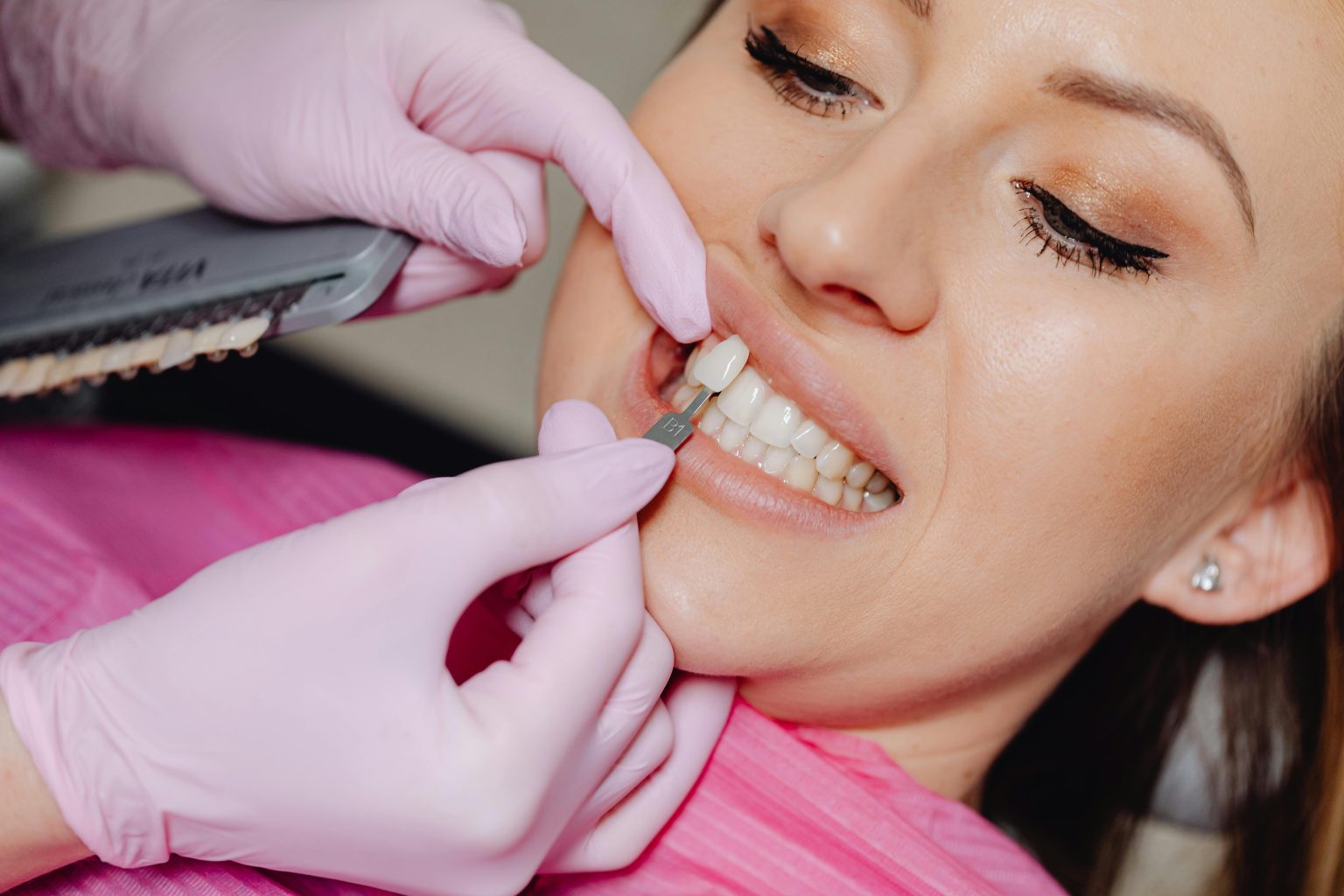 Benefits of Dental Veneers for a Perfect Smile