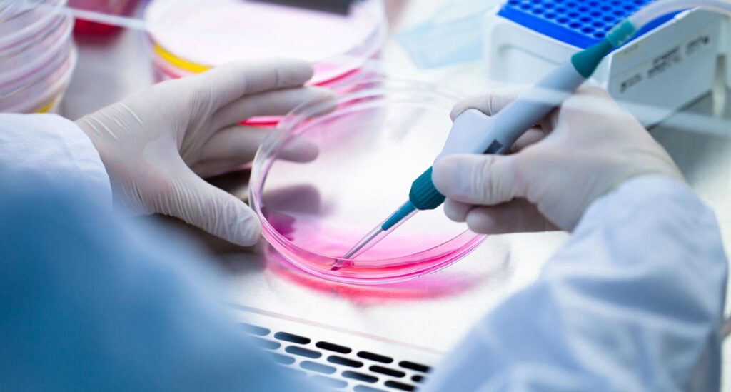 The Transformative Power of Stem Cell Benefits in Modern Medicine
